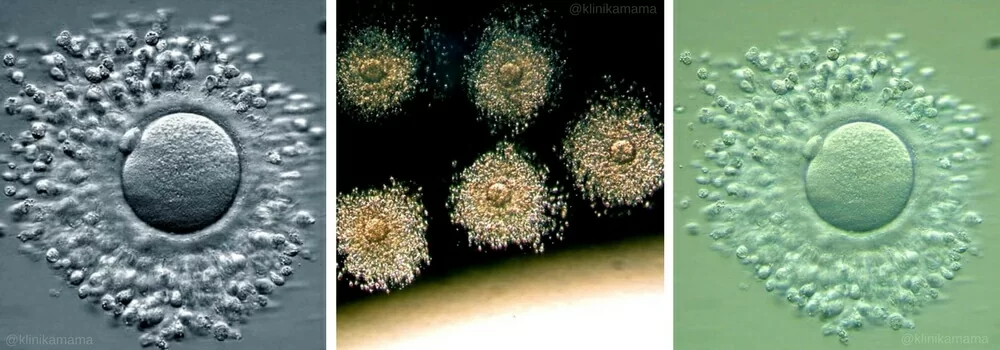 Эмбриология Клиники МАМА Эмбриология Клиники МАМА