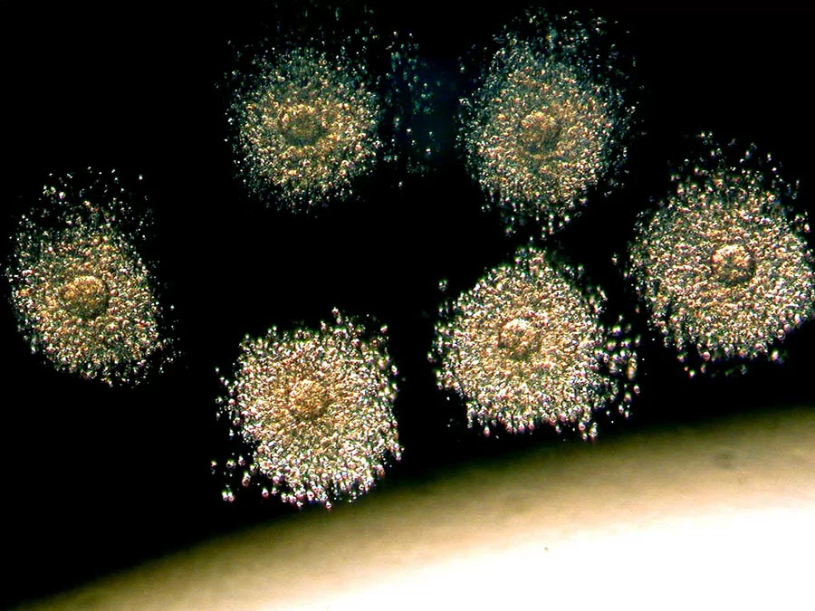 vitrifikatsiya-yaytsekletok.jpg vitrifikatsiya-yaytsekletok.jpg